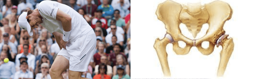 得了五冠王 得了五冠王